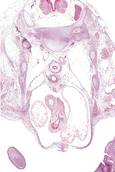 A histology section of a human embryo