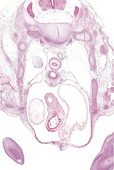 A histology section of a human embryo