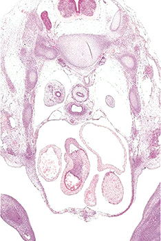 A histology section of a human embryo