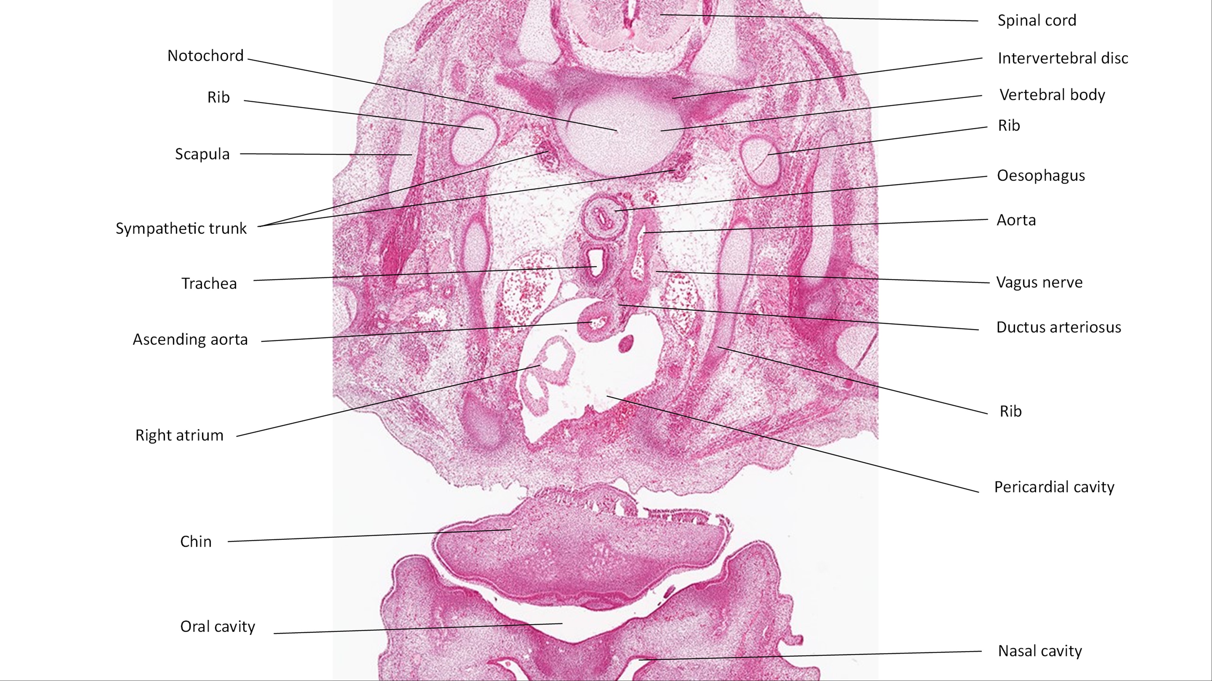 A histology section of a human embryo