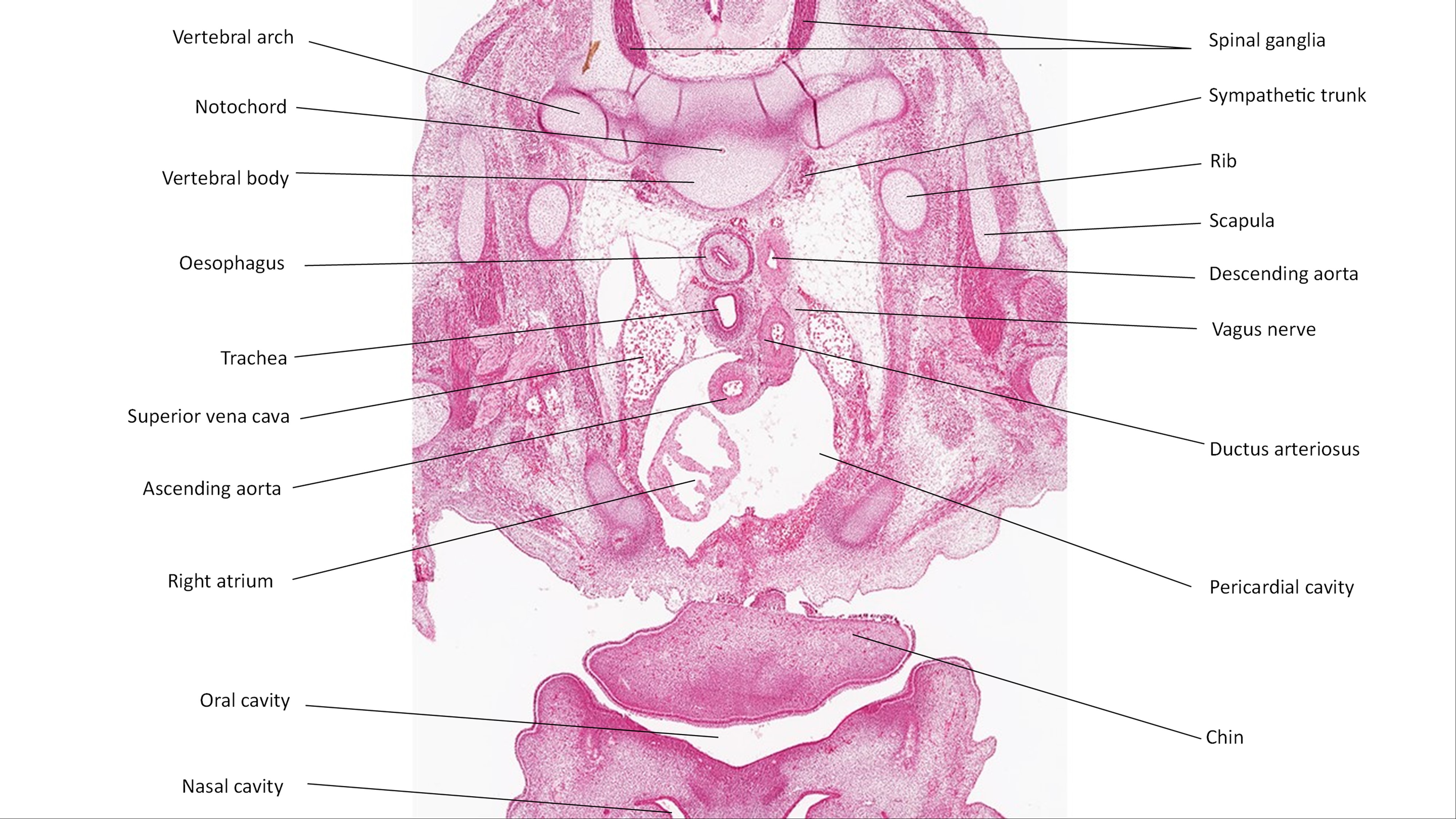 A histology section of a human embryo