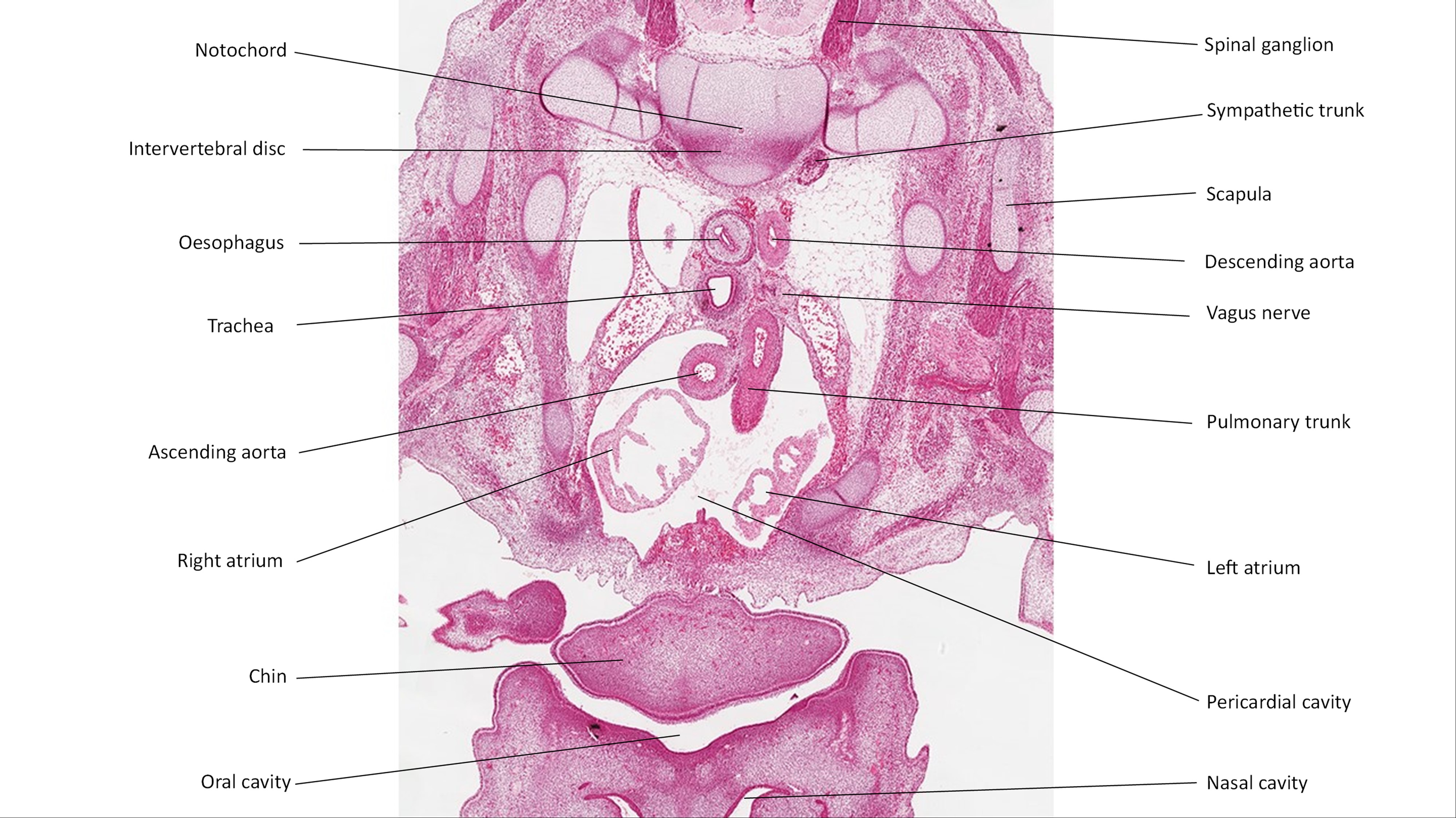 A histology section of a human embryo