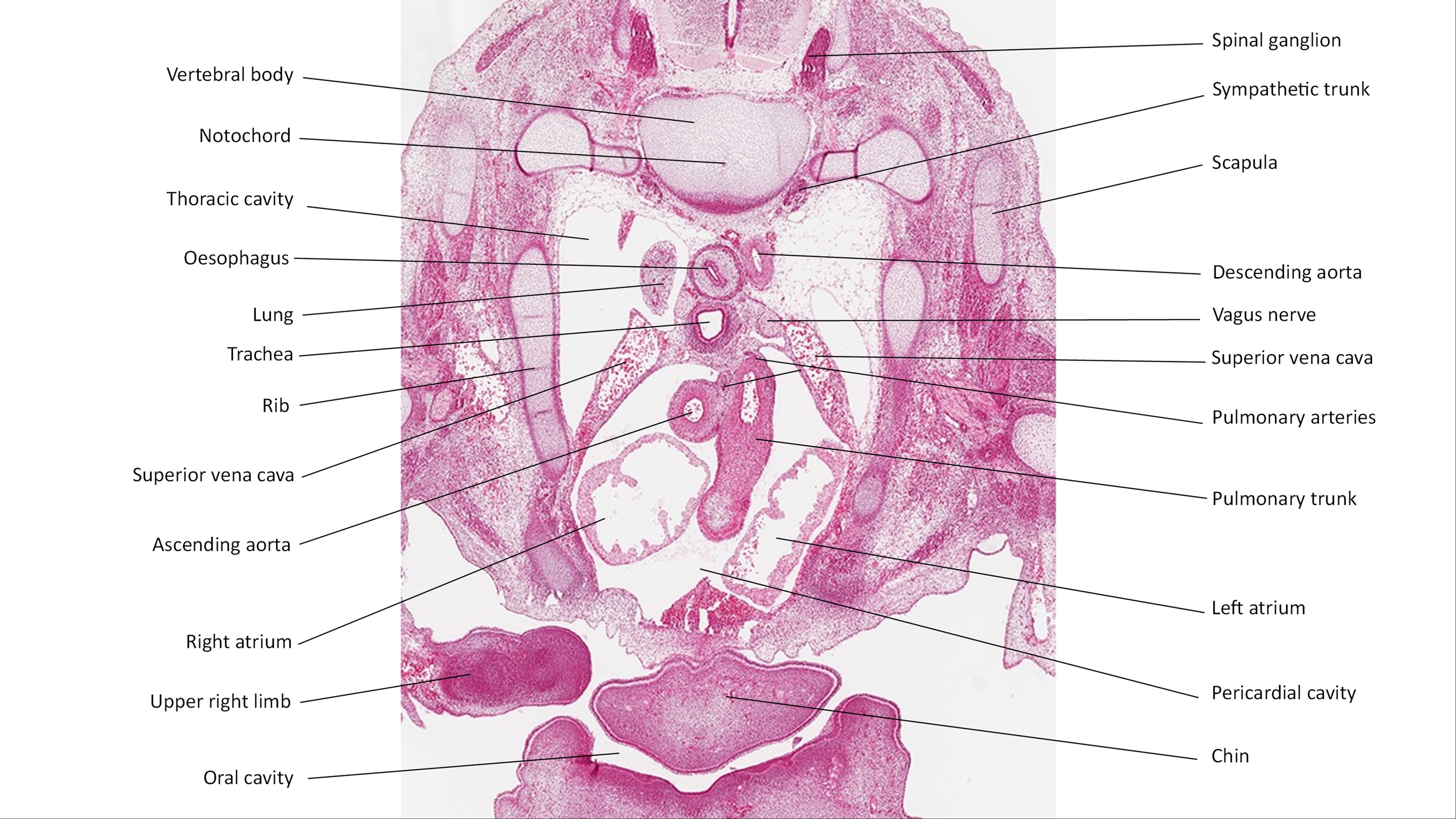 A histology section of a human embryo