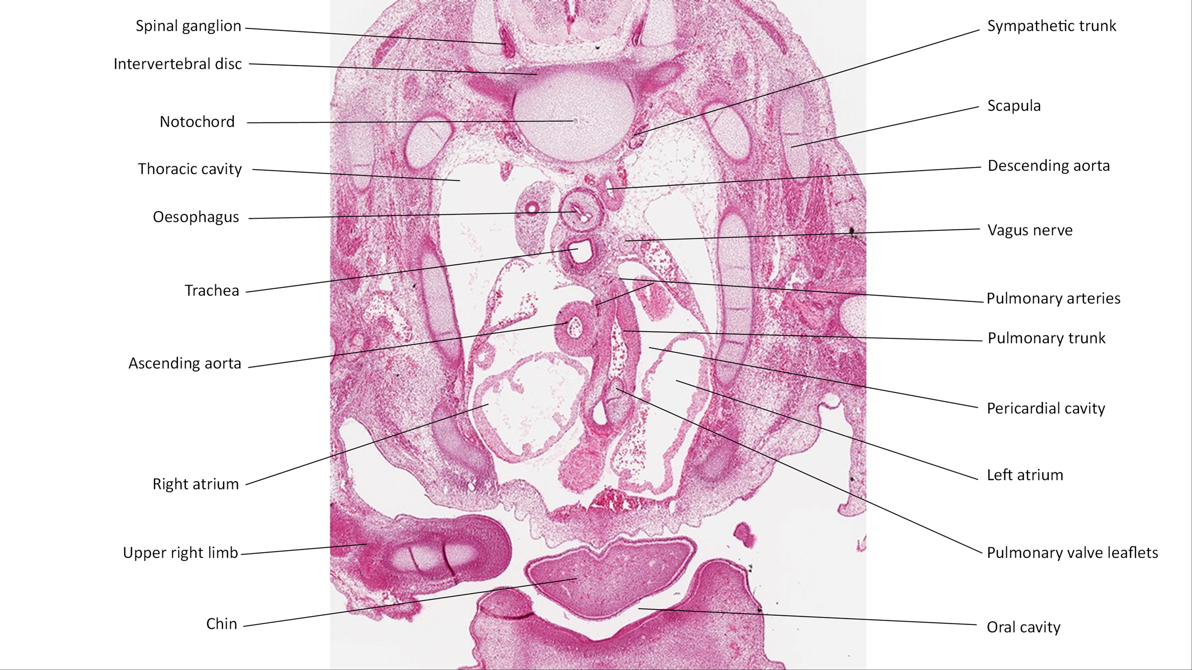 A histology section of a human embryo