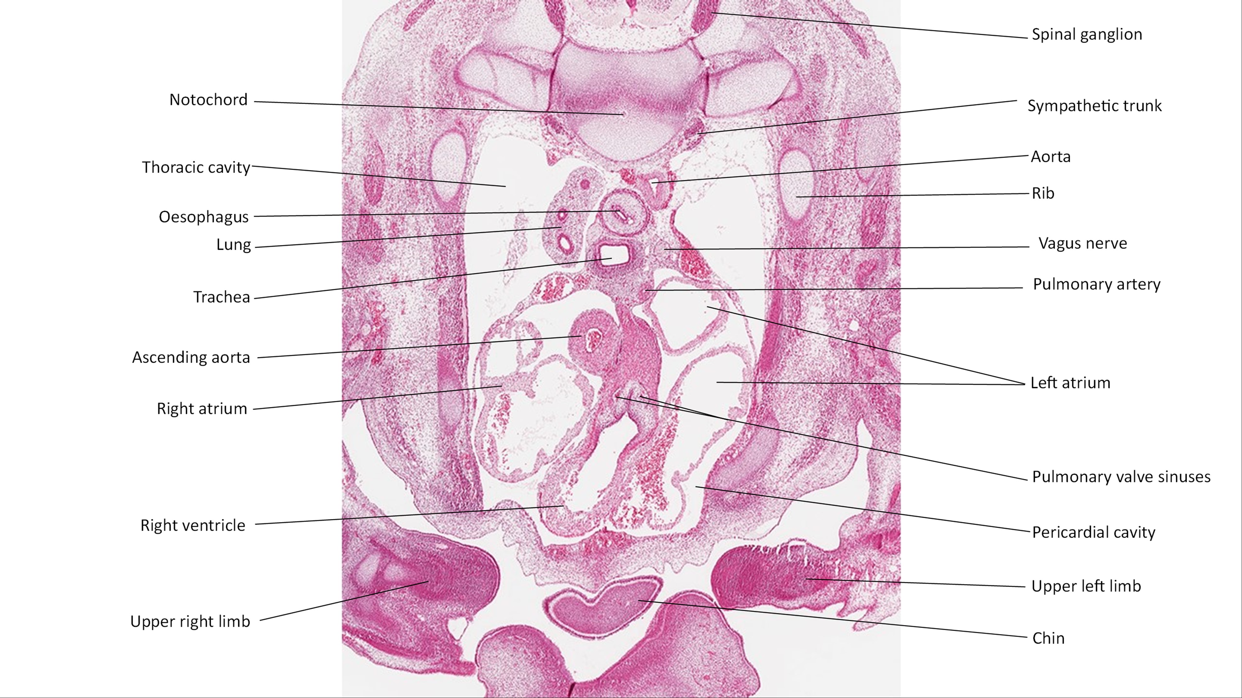A histology section of a human embryo
