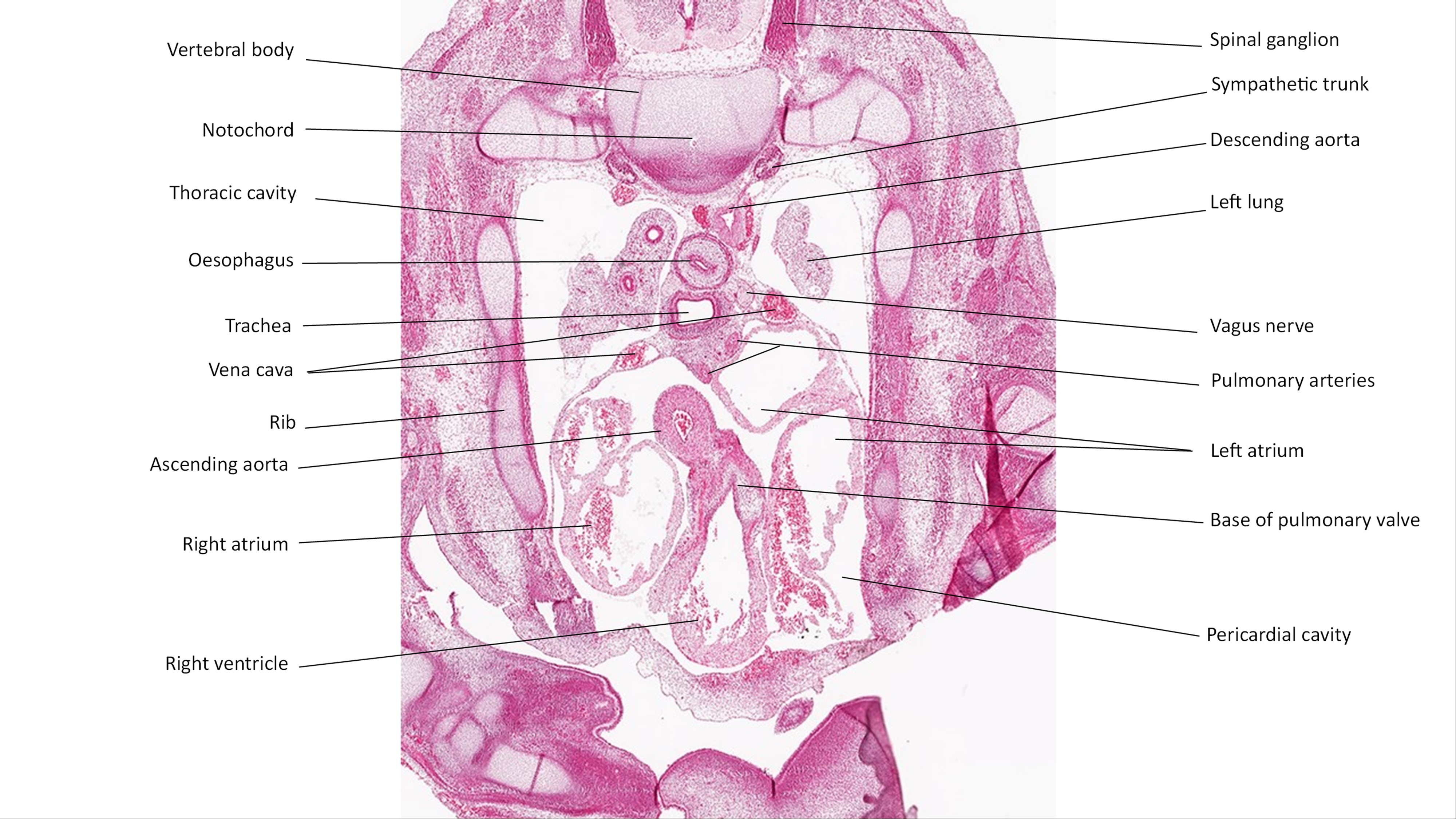 A histology section of a human embryo