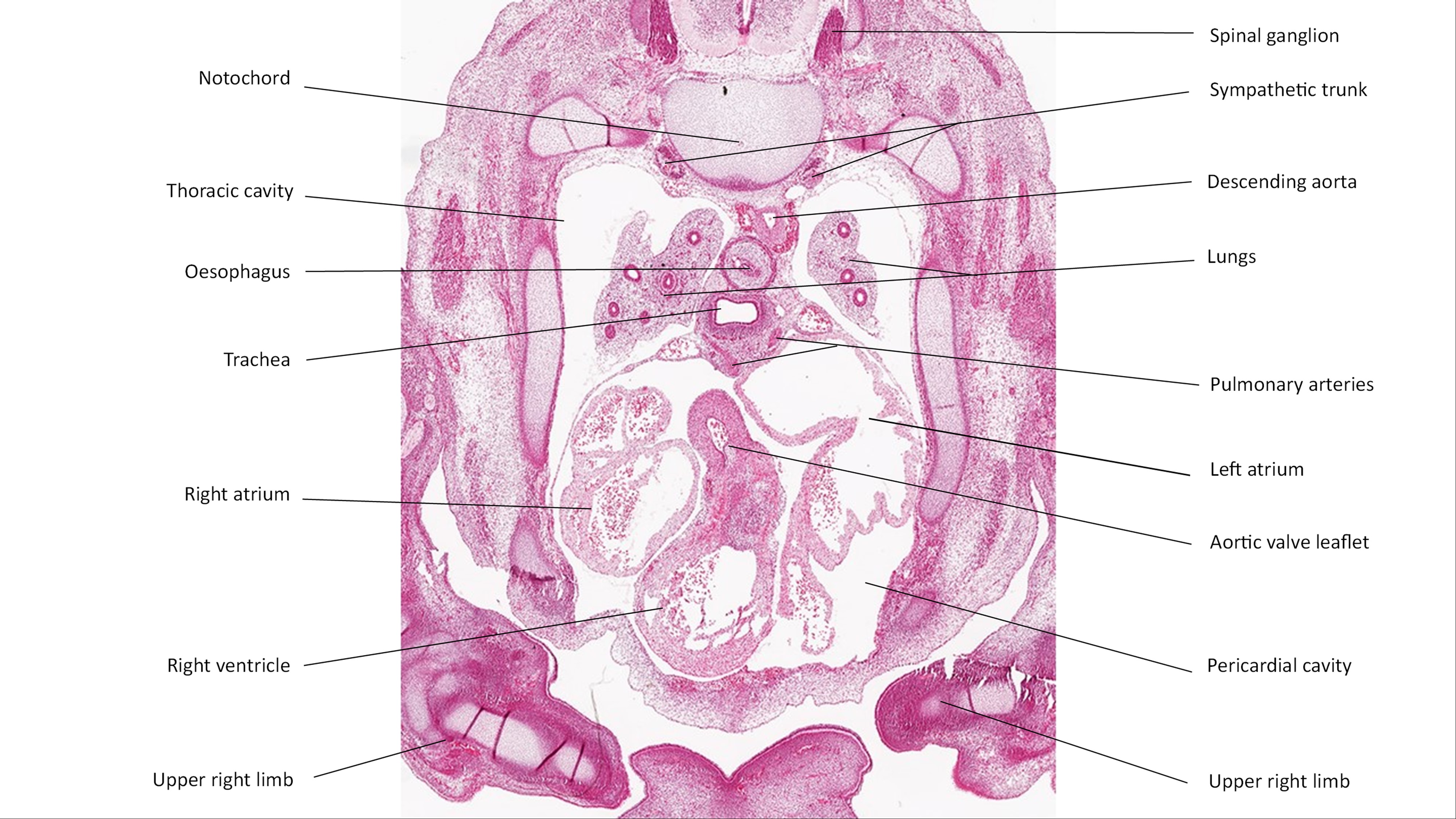 A histology section of a human embryo