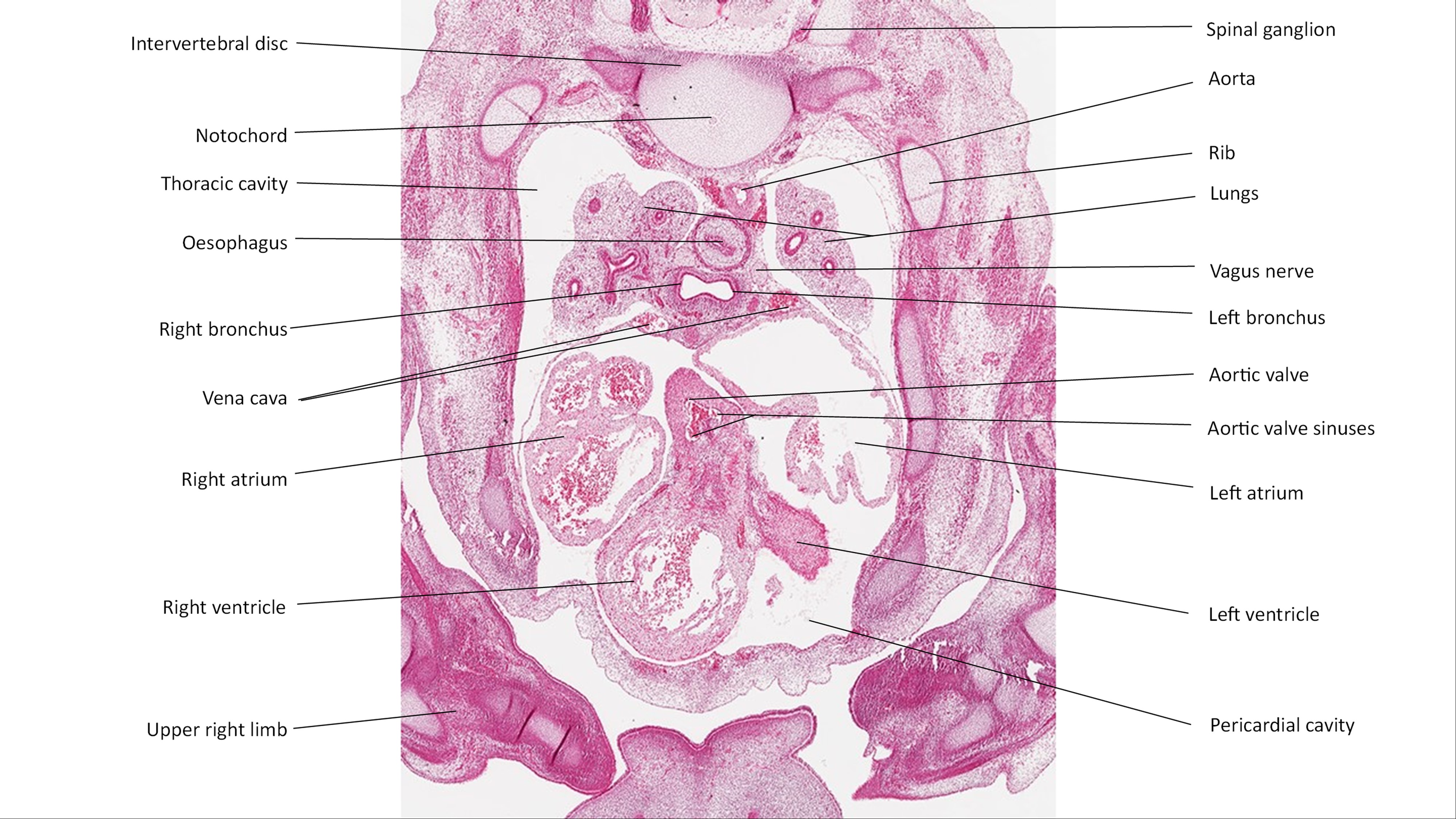 A histology section of a human embryo
