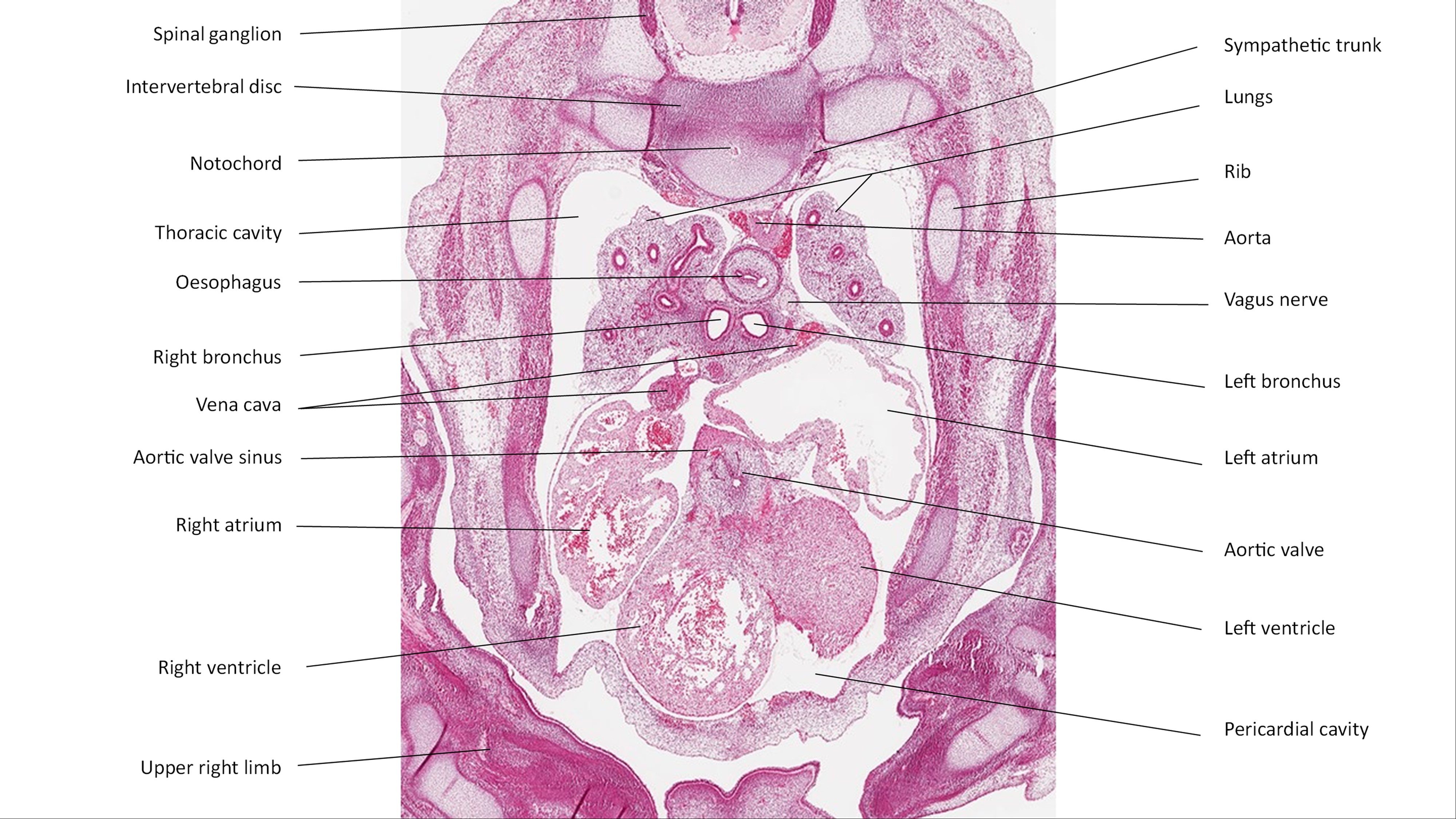 A histology section of a human embryo