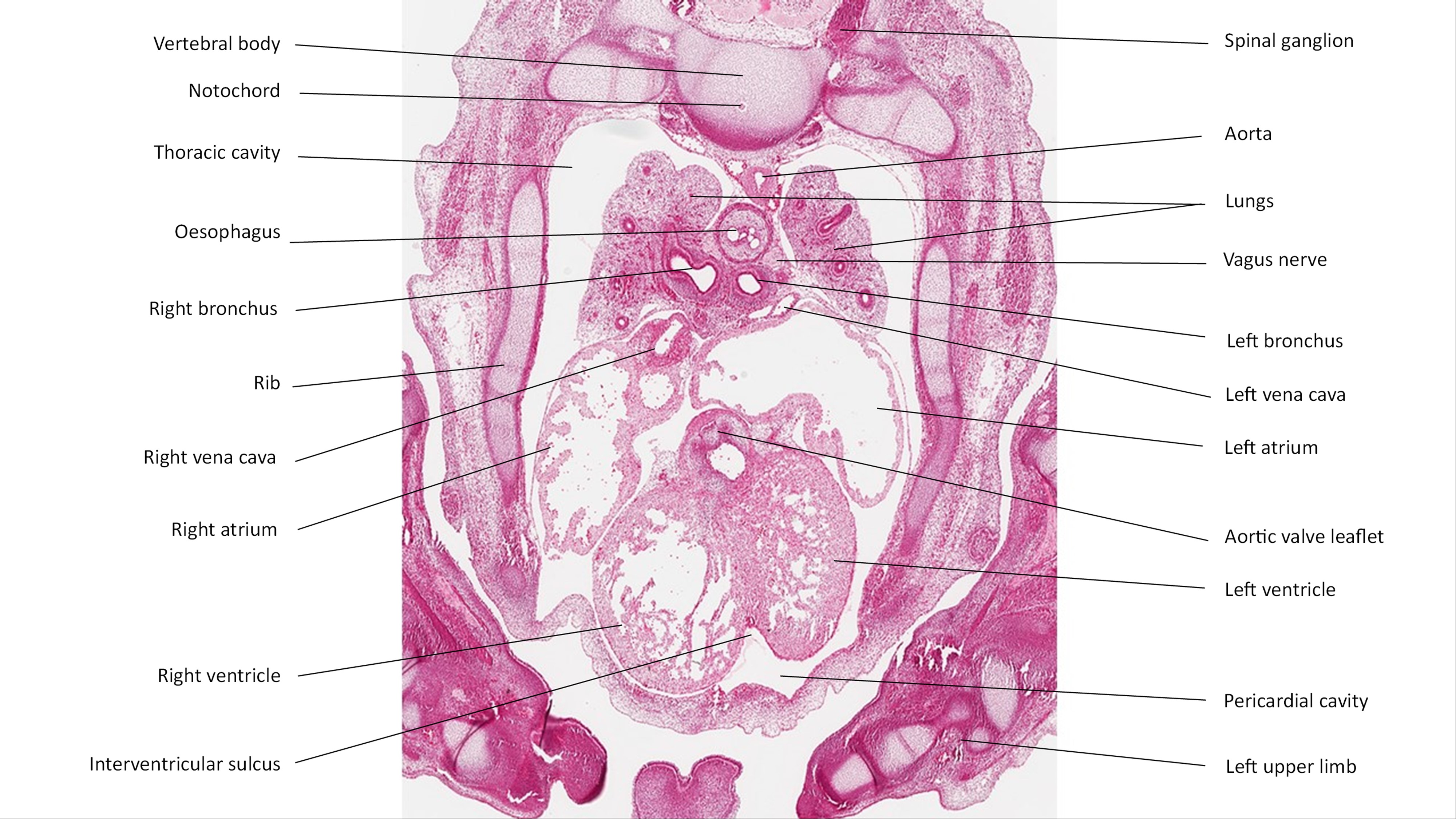 A histology section of a human embryo
