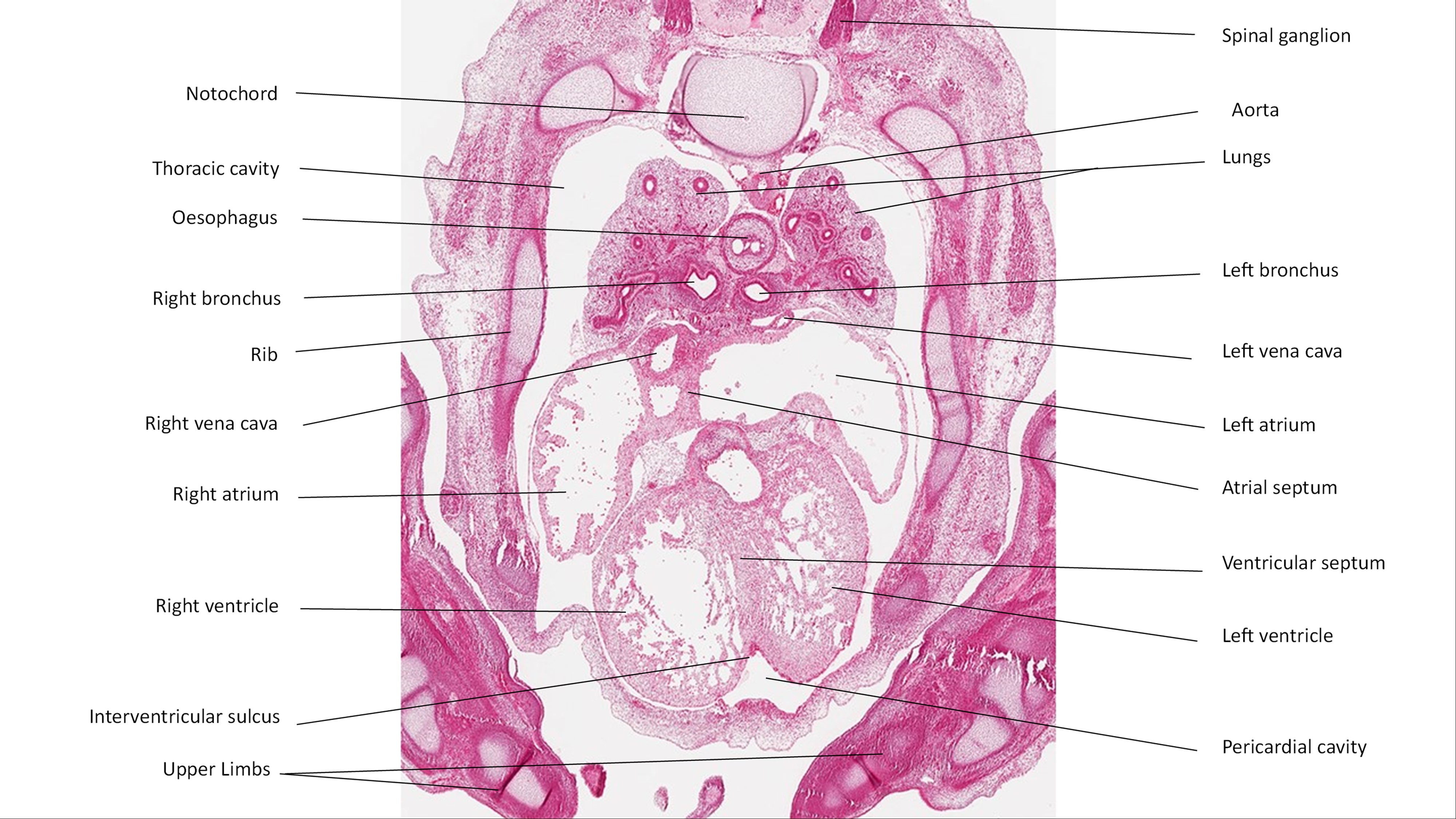 A histology section of a human embryo