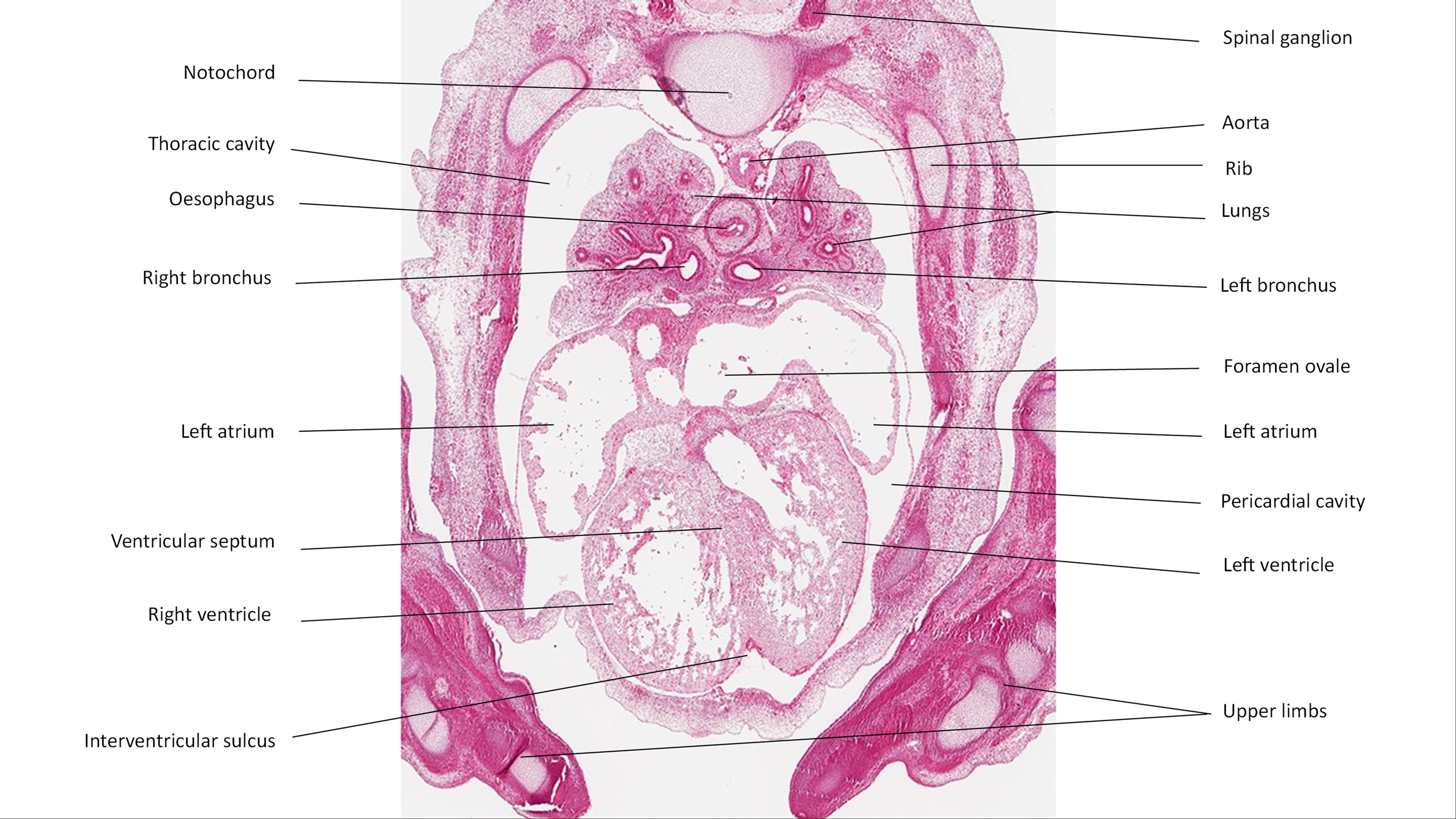 A histology section of a human embryo