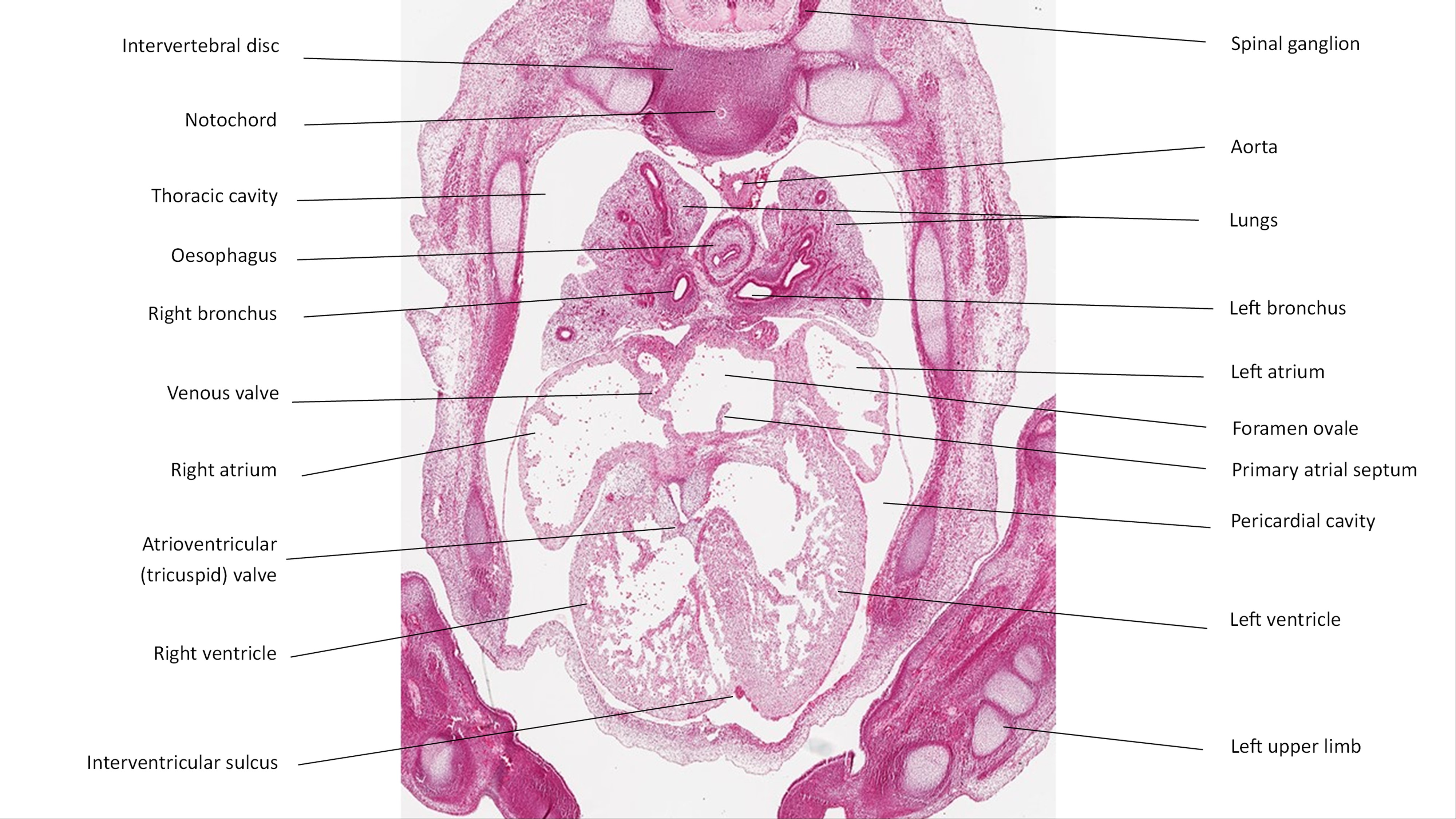 A histology section of a human embryo