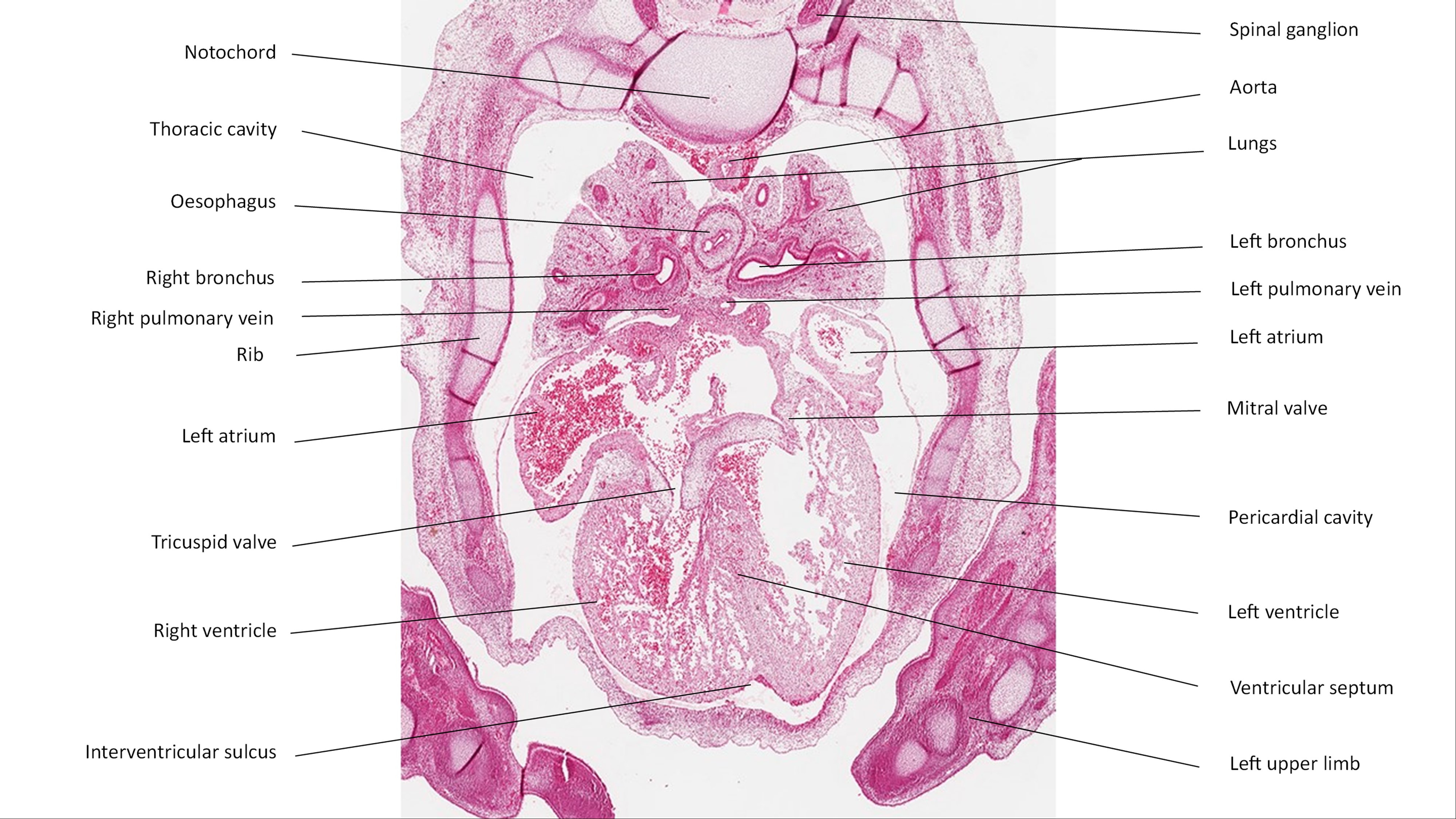 A histology section of a human embryo