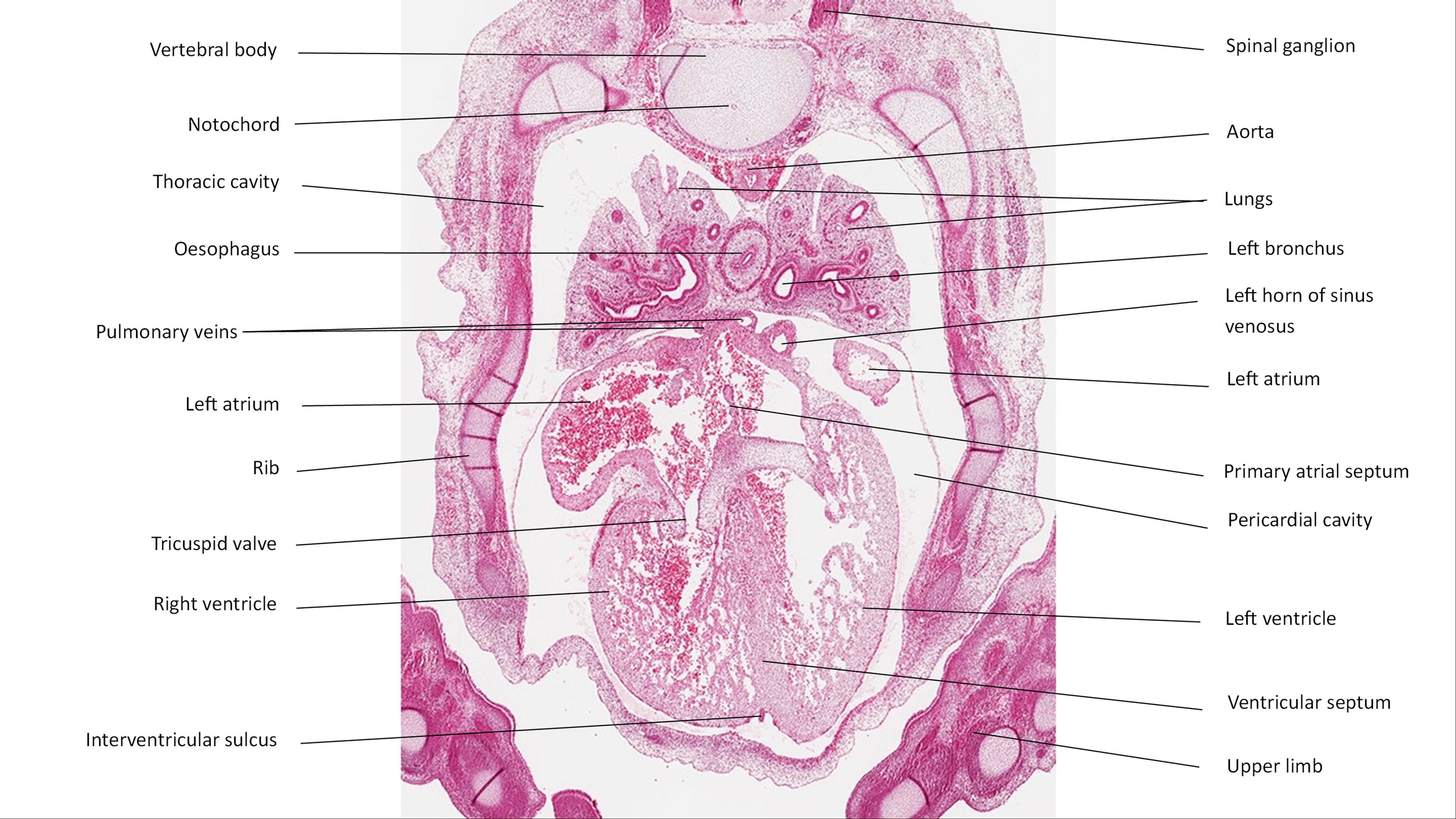 A histology section of a human embryo