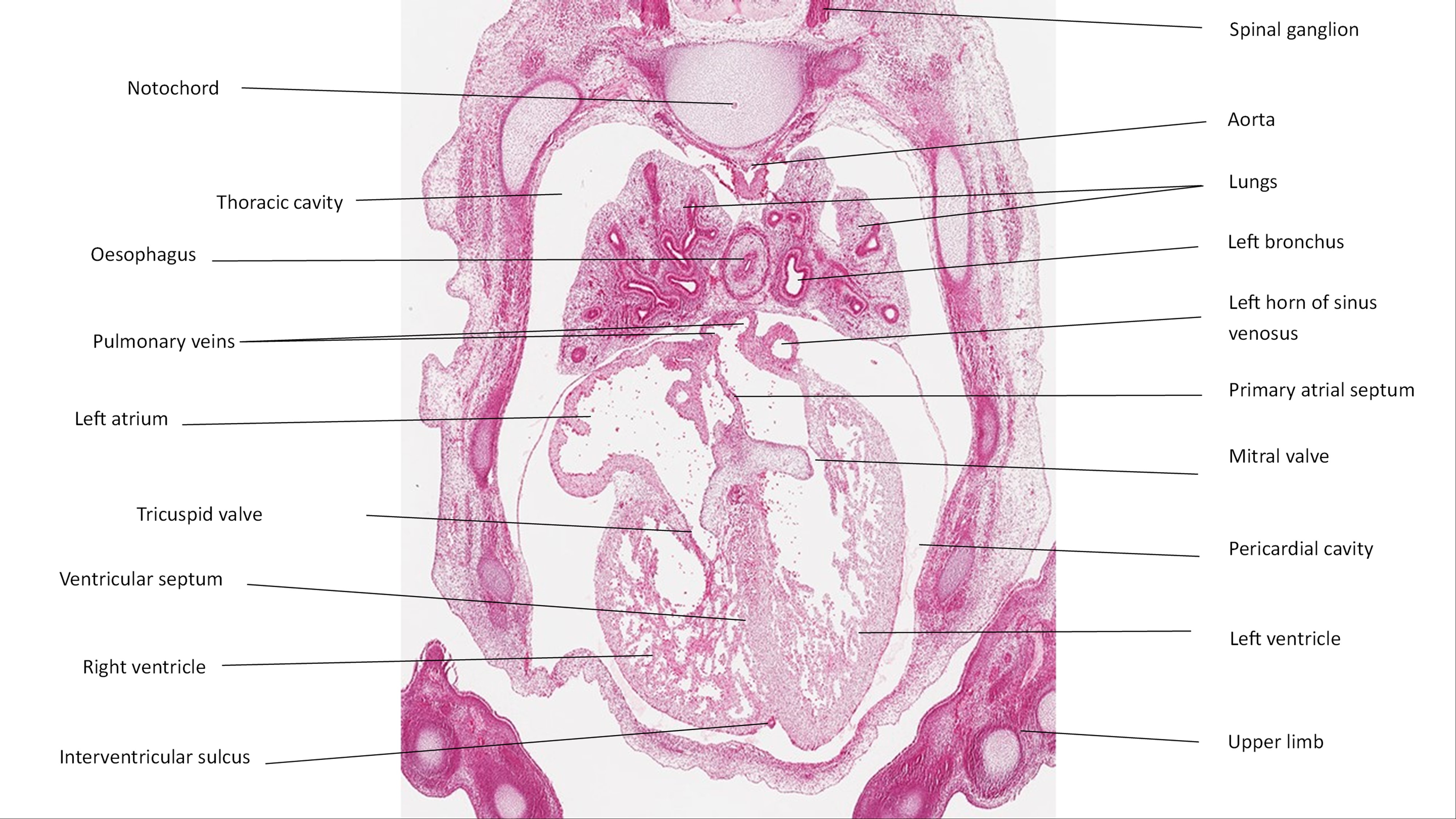 A histology section of a human embryo