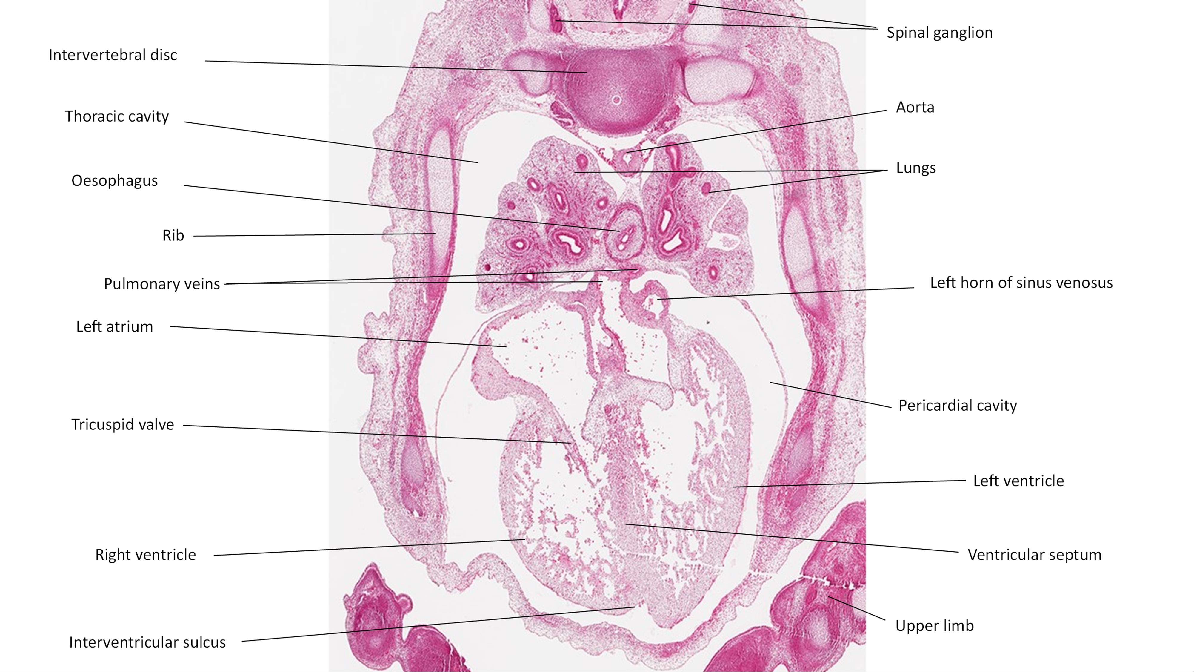 A histology section of a human embryo