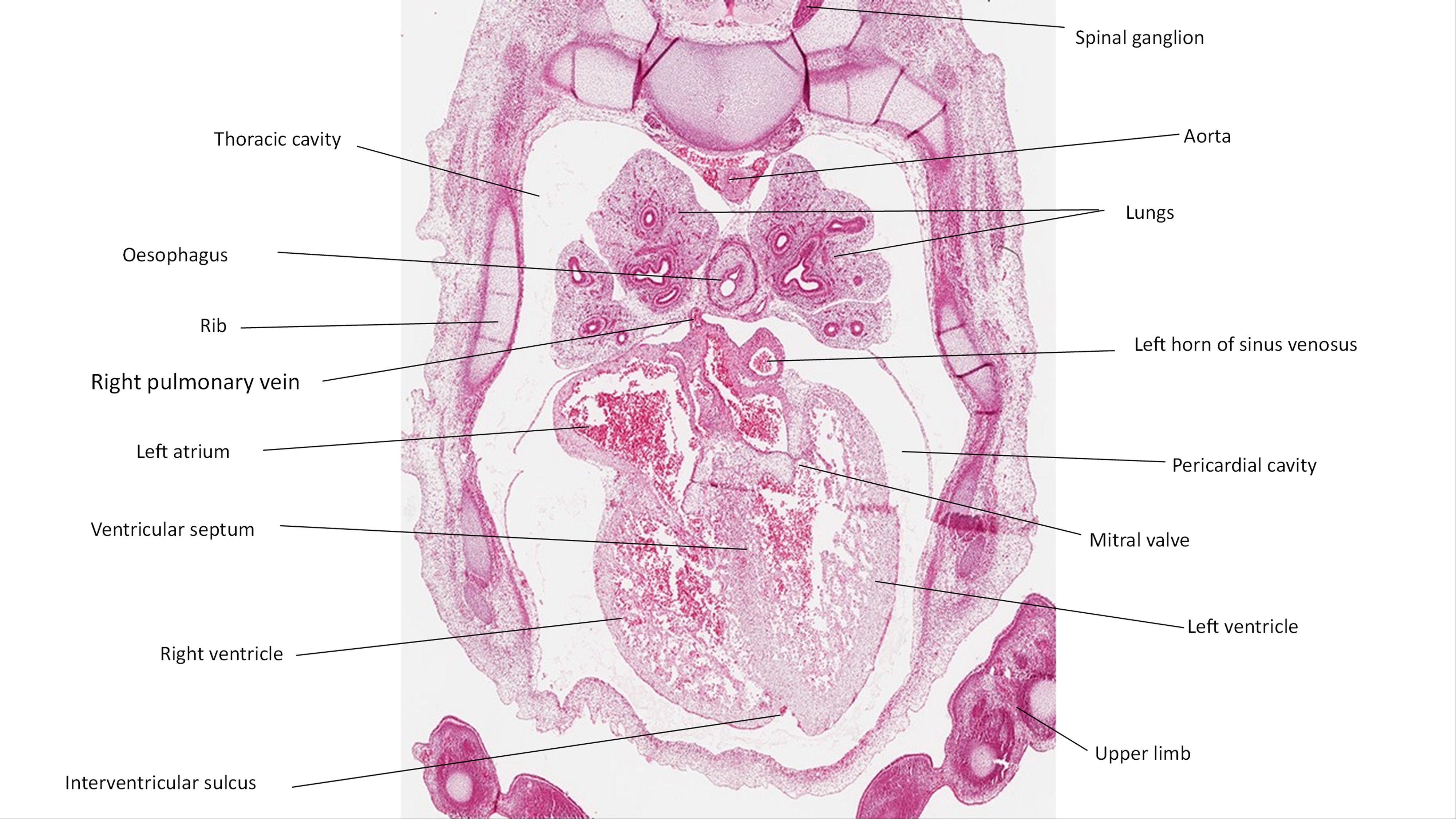 A histology section of a human embryo