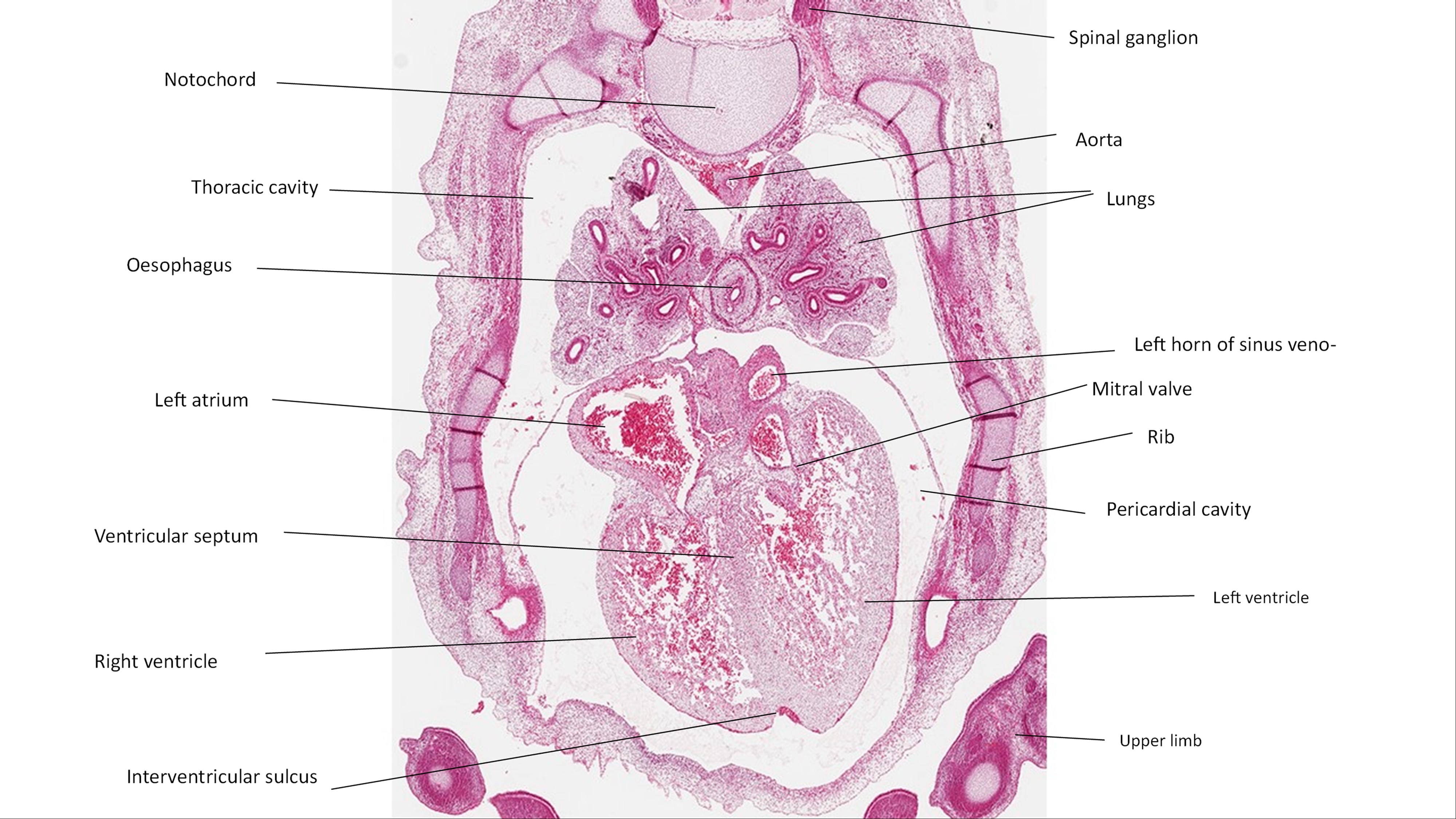 A histology section of a human embryo