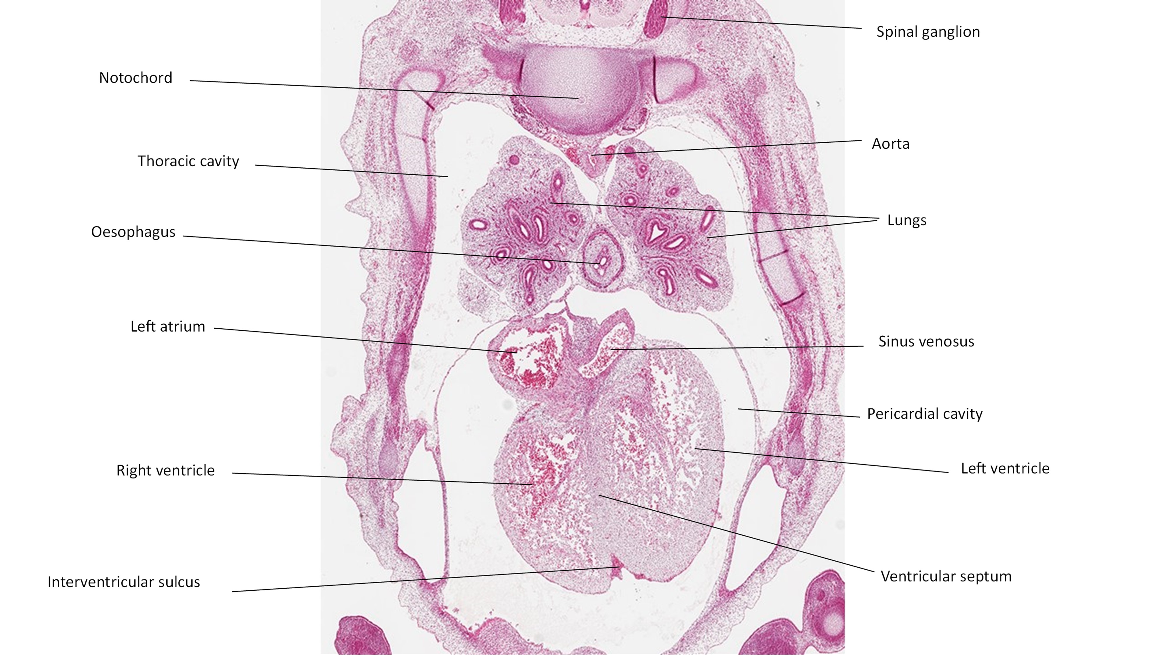 A histology section of a human embryo