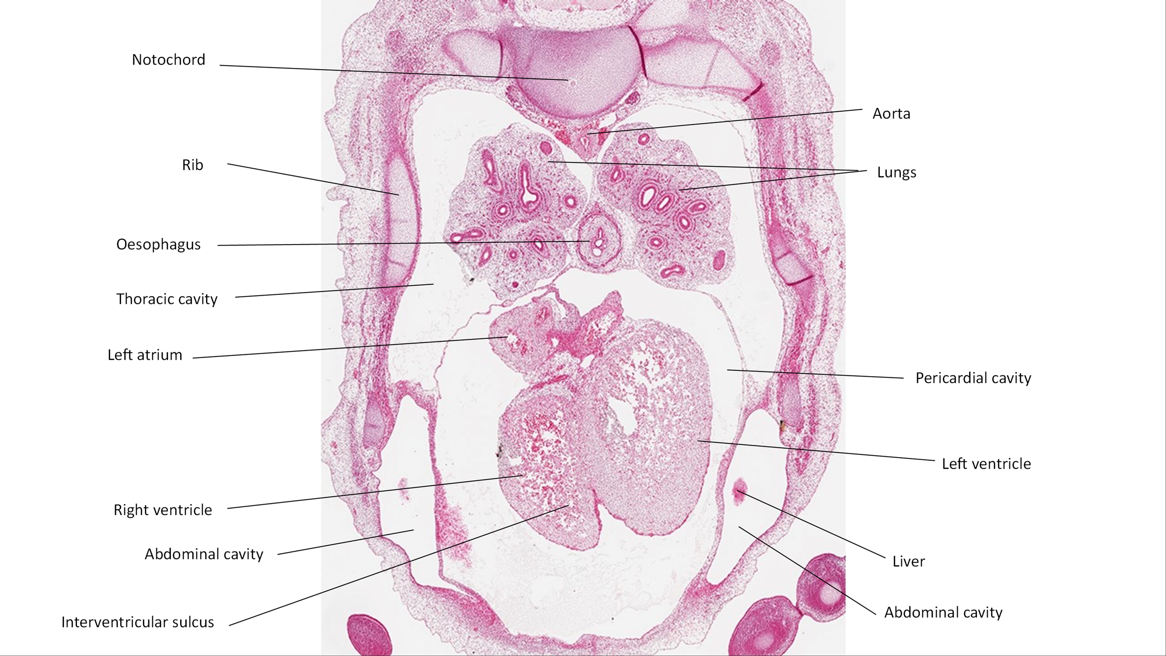 A histology section of a human embryo