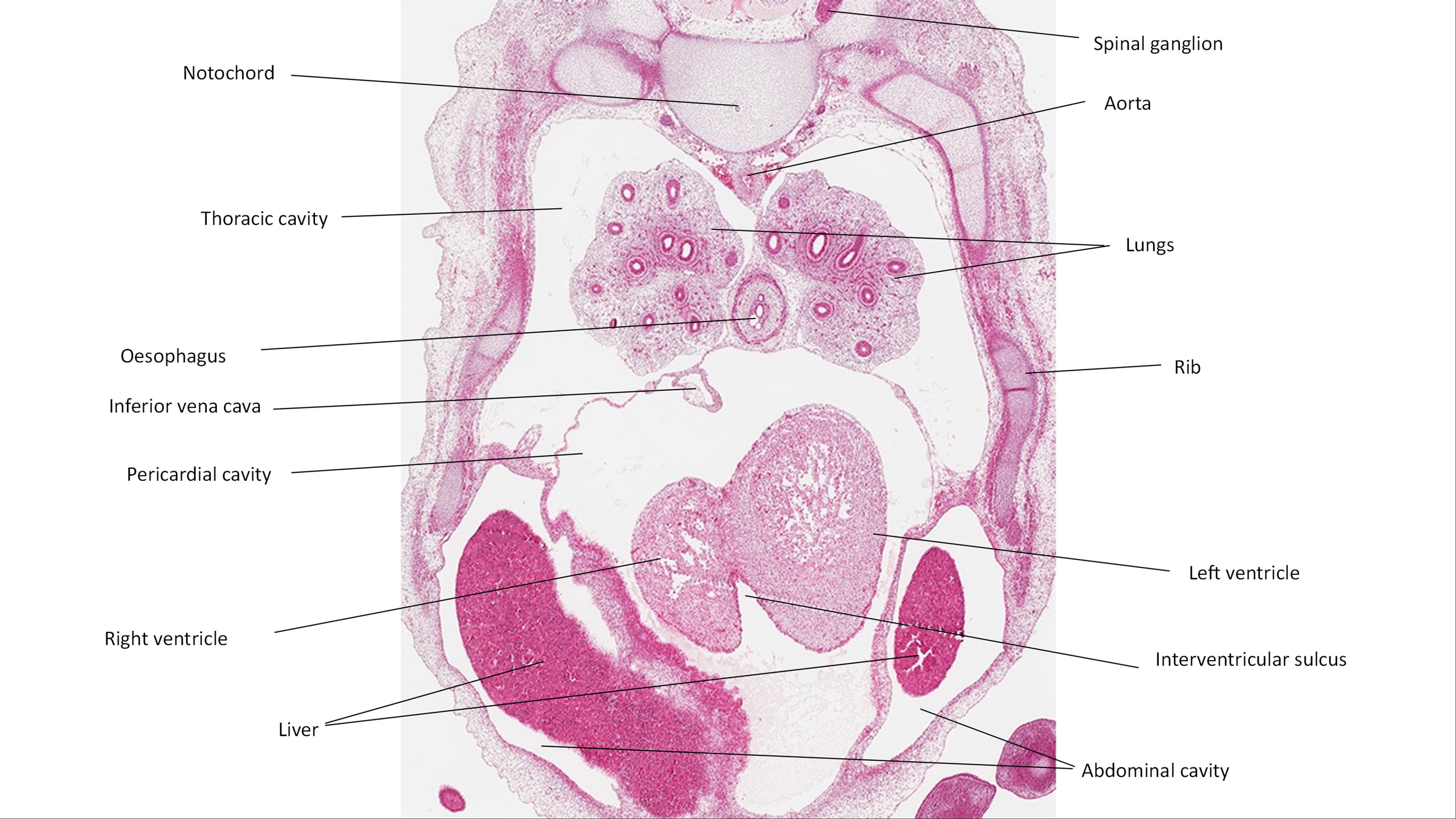 A histology section of a human embryo