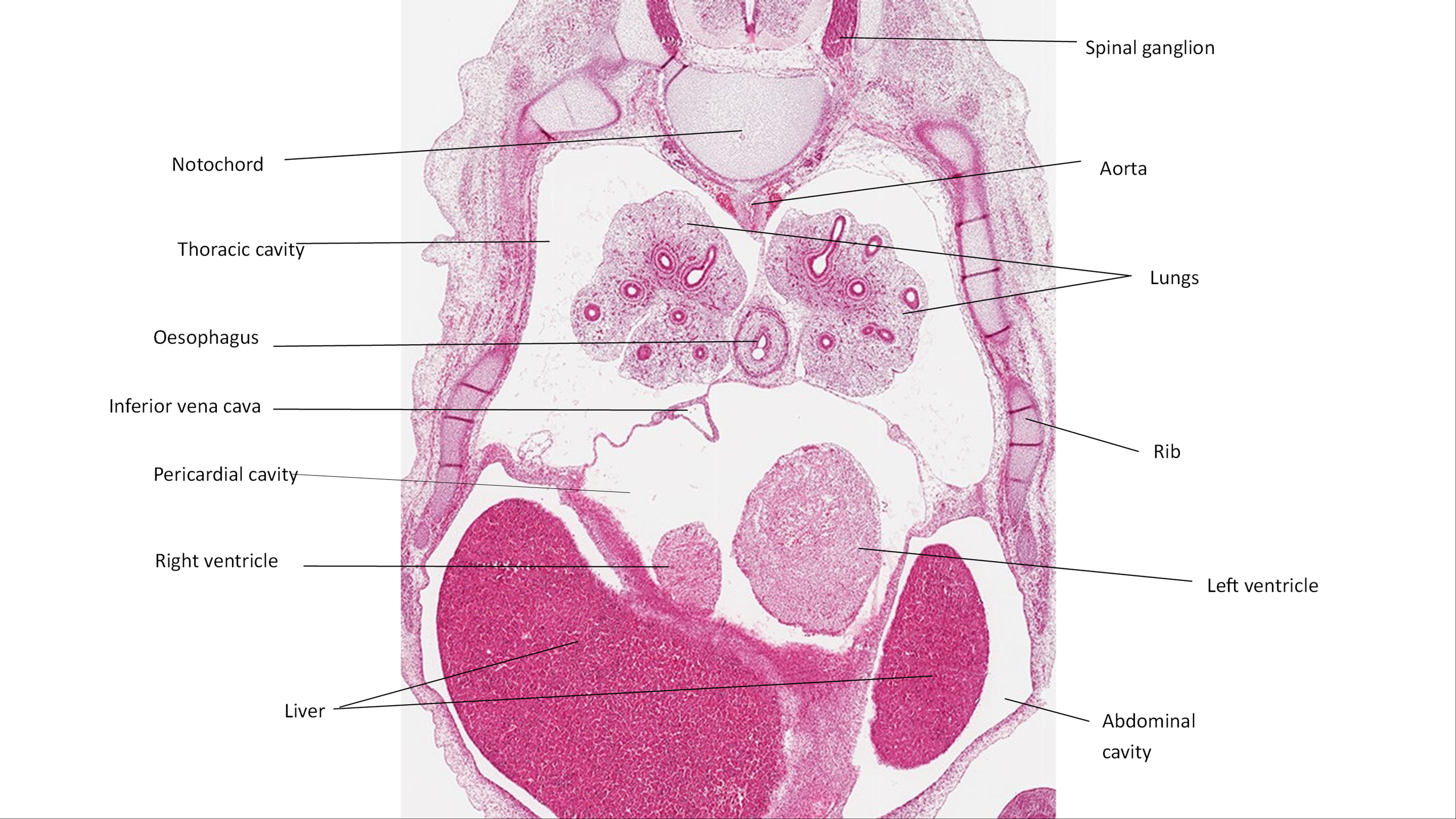 A histology section of a human embryo