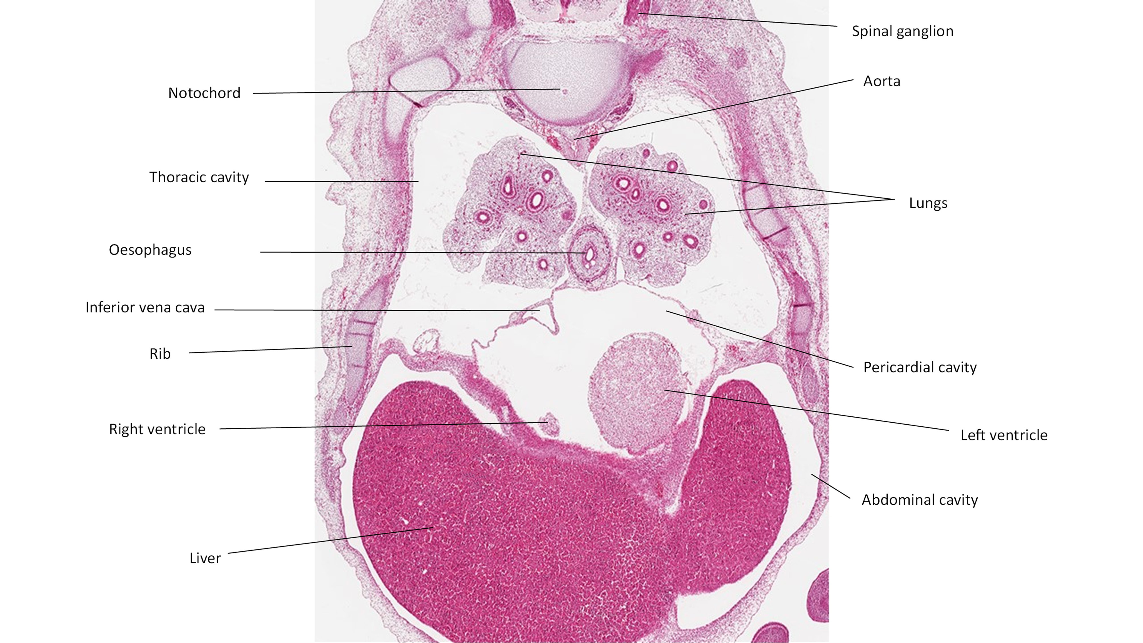 A histology section of a human embryo