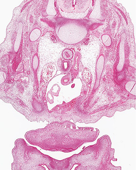 A histology section of a human embryo