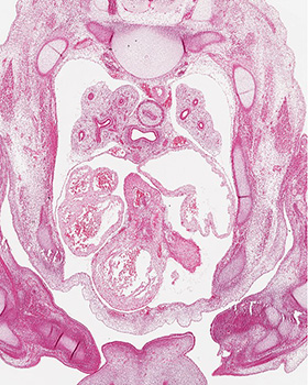 A histology section of a human embryo