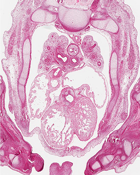 A histology section of a human embryo