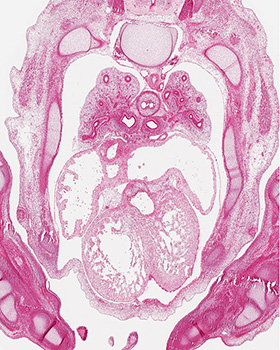 A histology section of a human embryo