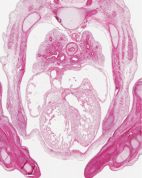 A histology section of a human embryo