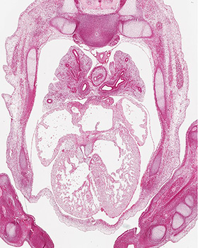A histology section of a human embryo