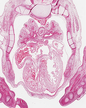 A histology section of a human embryo