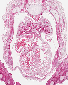 A histology section of a human embryo