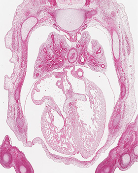 A histology section of a human embryo