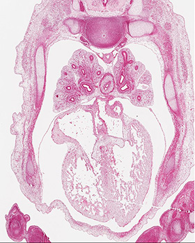 A histology section of a human embryo