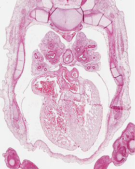 A histology section of a human embryo