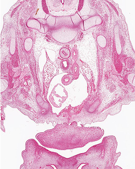 A histology section of a human embryo