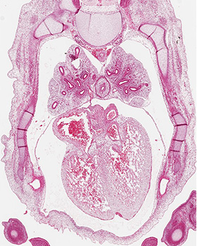 A histology section of a human embryo