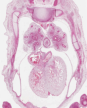 A histology section of a human embryo