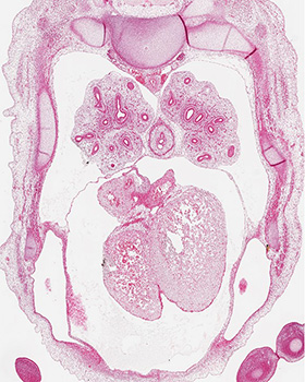 A histology section of a human embryo