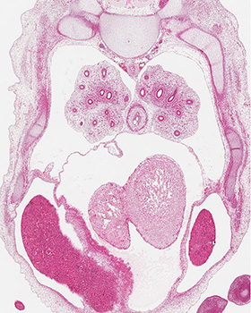 A histology section of a human embryo