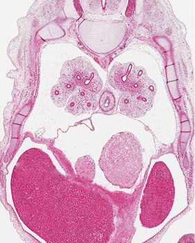 A histology section of a human embryo