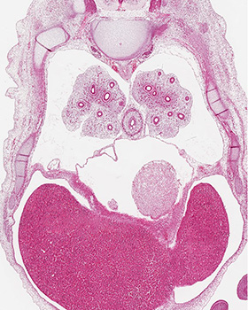 A histology section of a human embryo