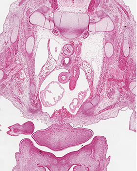 A histology section of a human embryo