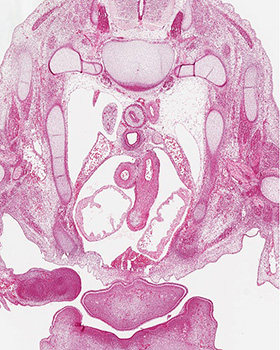 A histology section of a human embryo