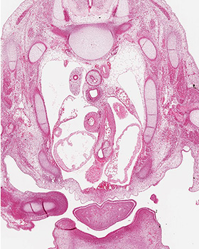 A histology section of a human embryo