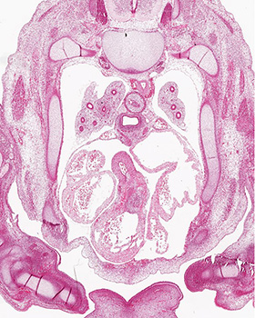 A histology section of a human embryo